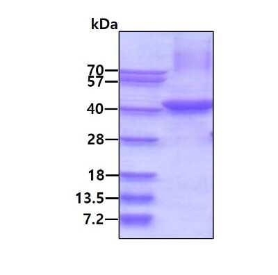 SDS-PAGE Recombinant Human HPR His Protein